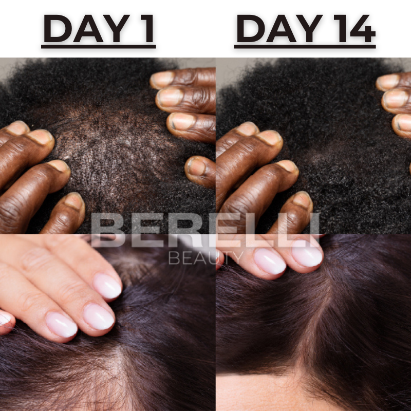Berelli© Hair Growth Scalp Ampoule